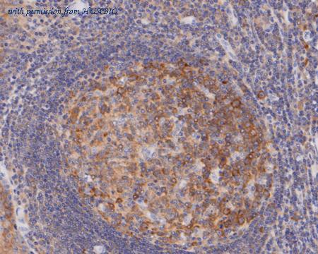 HUABIO ET7110-18 image 3