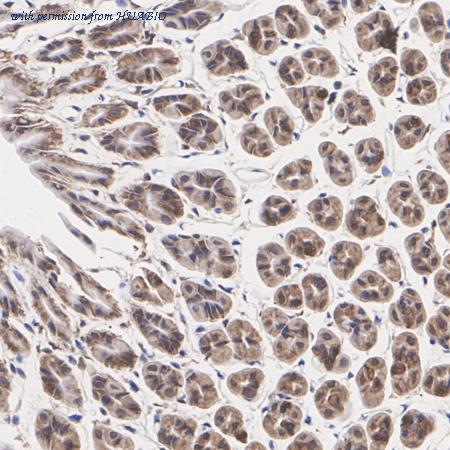 HUABIO ET7110-19 image 3