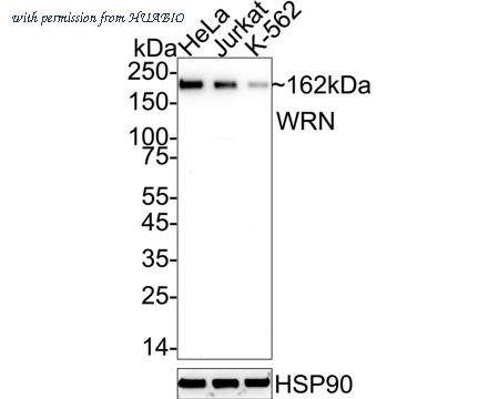 HUABIO ET7110-26 image 1