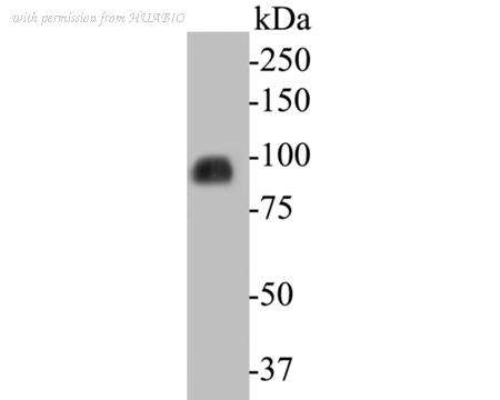 HUABIO ET7110-28 image 1