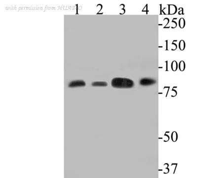HUABIO ET7110-31 image 1
