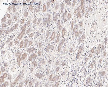 HUABIO ET7110-33 image 3