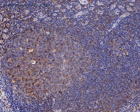 HUABIO ET7110-39 image 3