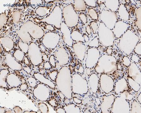 HUABIO ET7110-52 image 3