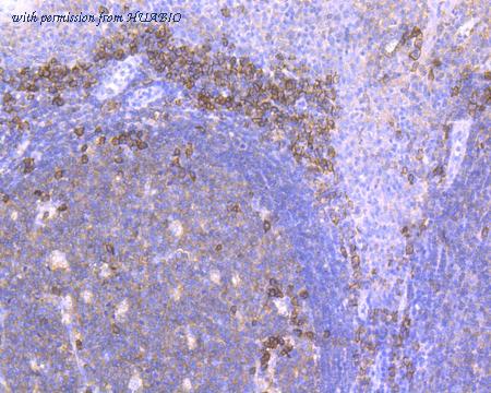 HUABIO ET7110-53 image 2