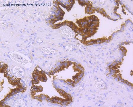 HUABIO ET7110-53 image 3