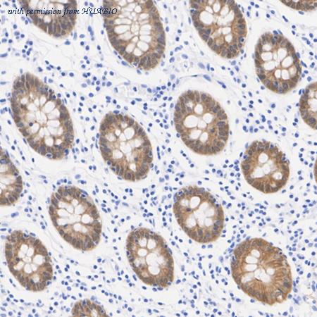 HUABIO ET7110-55 image 2