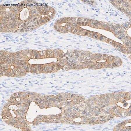 HUABIO ET7110-55 image 3