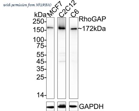 HUABIO ET7110-65 image 1