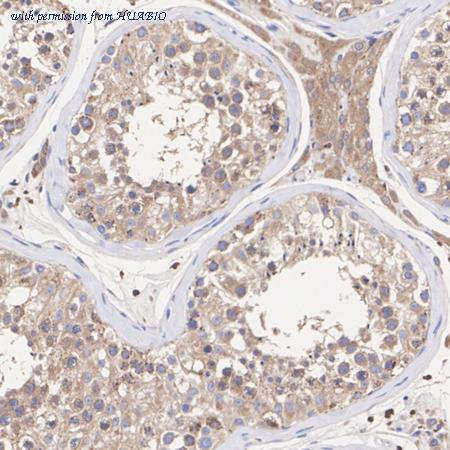 HUABIO ET7110-65 image 3