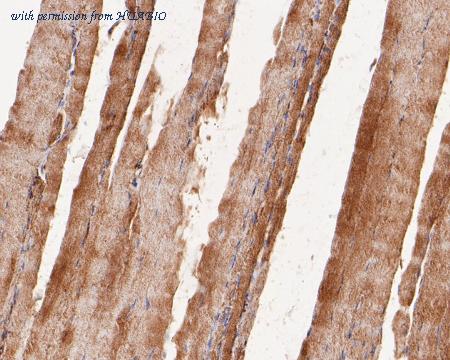 HUABIO ET7110-71 image 3