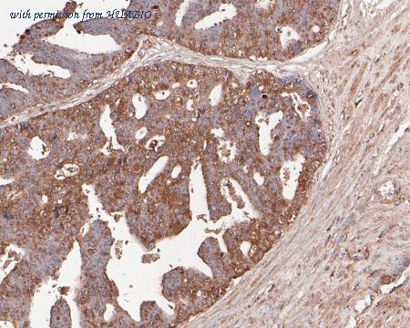 HUABIO ET7110-74 image 2