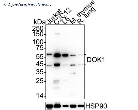 HUABIO ET7110-75 image 1