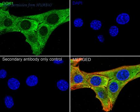 HUABIO ET7110-75 image 3