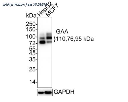 HUABIO ET7110-77 image 1