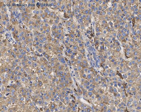 HUABIO ET7110-77 image 3