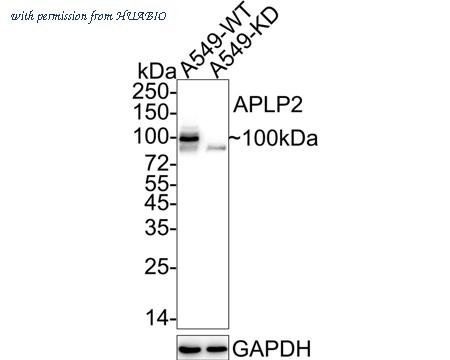 HUABIO ET7110-78 image 1