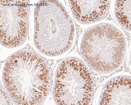 HUABIO ET7110-78 image 3