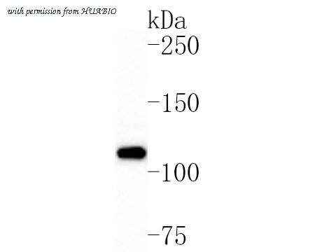 HUABIO ET7110-80 image 1