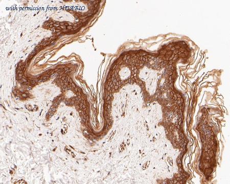 HUABIO ET7110-80 image 3