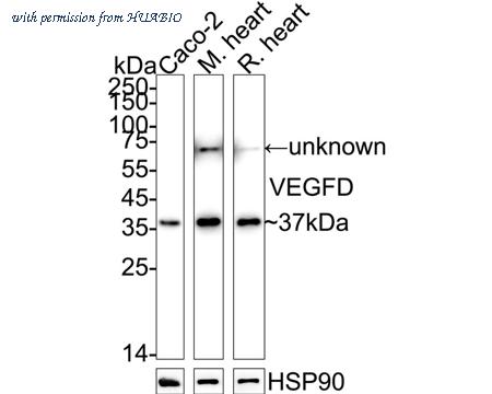 HUABIO ET7110-81 image 1