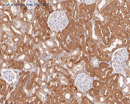 HUABIO ET7110-81 image 3