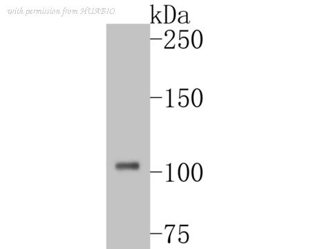 HUABIO ET7110-83 image 1