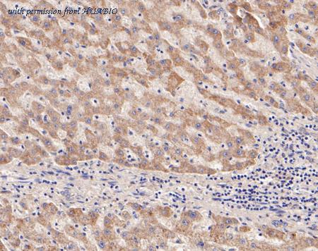 HUABIO ET7110-83 image 3