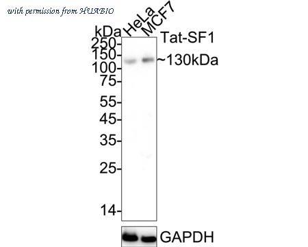 HUABIO ET7110-87 image 1