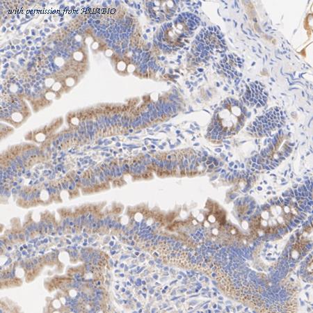 HUABIO ET7110-89 image 3