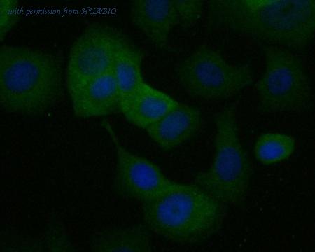 HUABIO ET7110-90 image 2