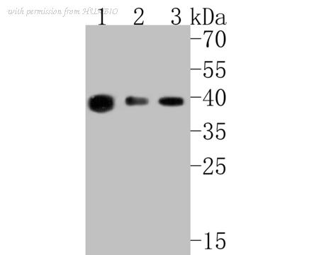 HUABIO ET7110-91 image 2