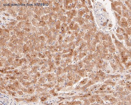 HUABIO ET7110-91 image 3