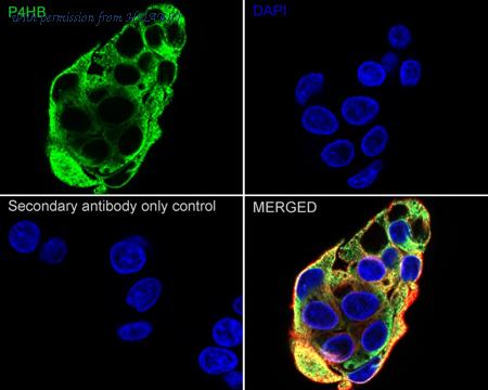 HUABIO ET7110-92 image 3