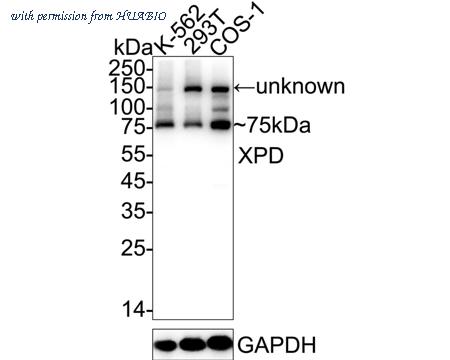 HUABIO ET7110-93 image 1
