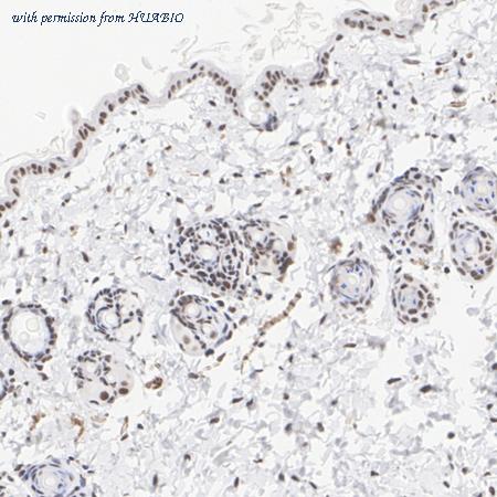 HUABIO ET7110-93 image 3