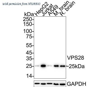 HUABIO ET7110-94 image 1