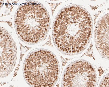 HUABIO ET7110-95 image 2