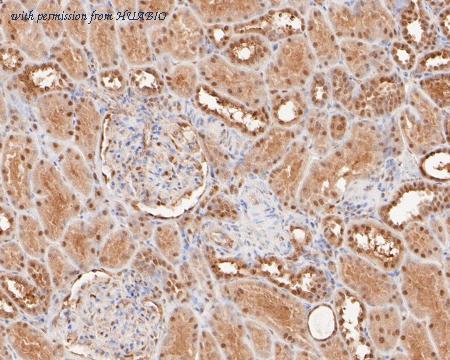 HUABIO ET7110-95 image 3