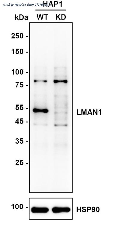 HUABIO ET7110-98 image 1