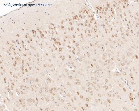 HUABIO ET7110-98 image 3