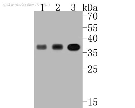HUABIO ET7110-99 image 1
