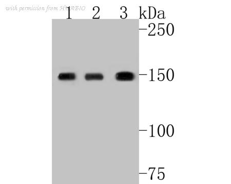 HUABIO ET7111-01 image 1