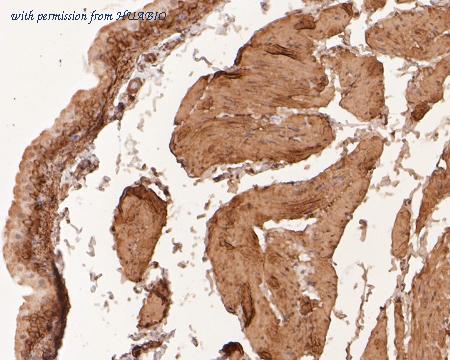 HUABIO ET7111-02 image 3