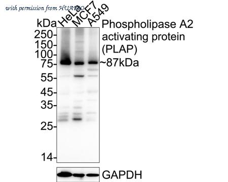HUABIO ET7111-06 image 1