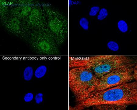 HUABIO ET7111-06 image 2