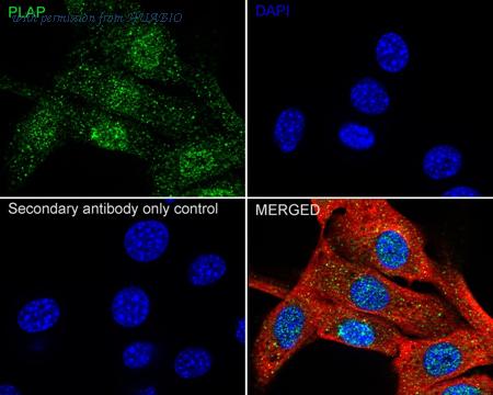 HUABIO ET7111-06 image 3