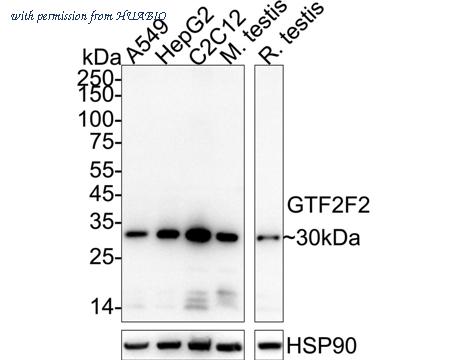HUABIO ET7111-08 image 1