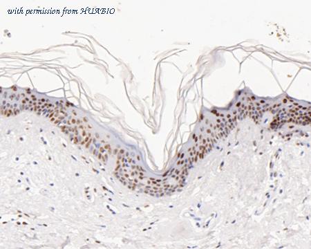 HUABIO ET7111-08 image 2