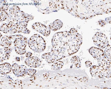 HUABIO ET7111-08 image 3